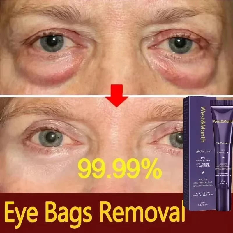 đď¸ Instant Eye Bag Removal Cream
