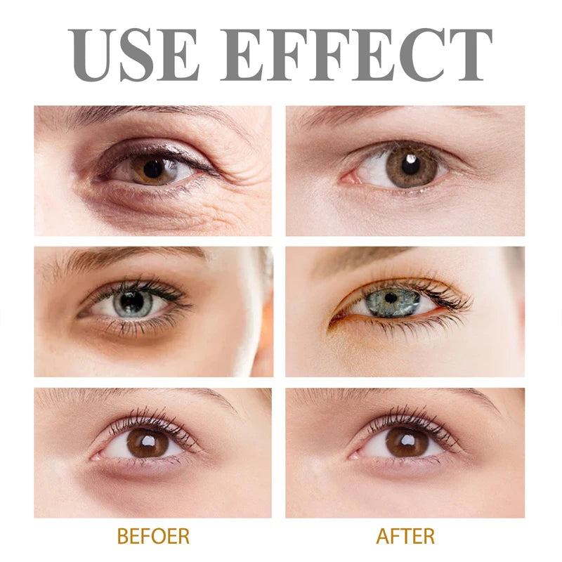 👁️ Instant Eye Bag Removal Cream