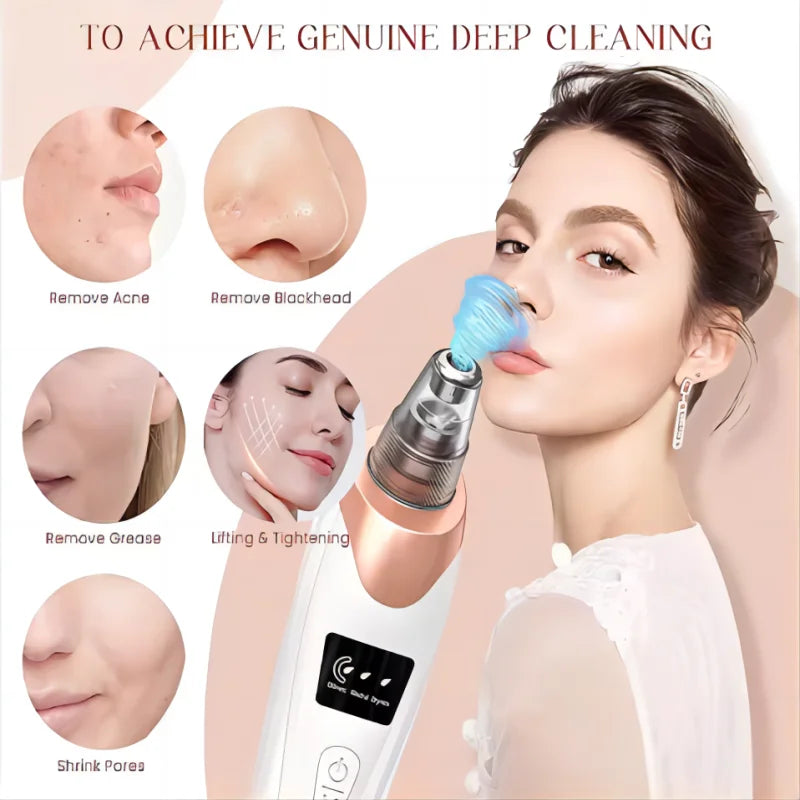 Pro Blackhead Vacuum – Deep Clean, Pore Perfect