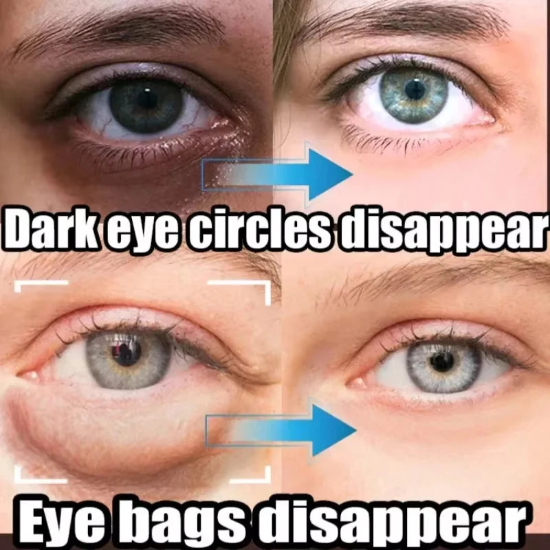 👁️ Instant Eye Bag Removal Cream