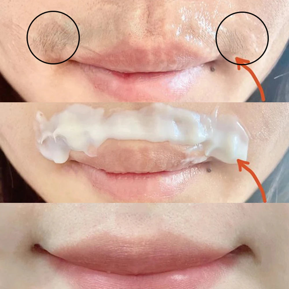 Lip Hair Removal Kit